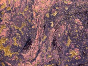 Comparative Study of Polyclonal Versus Monoclonal Antibodies in Laboratory Applications