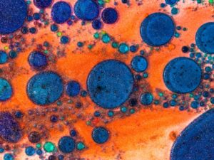 The Importance of Antibody Affinity and Specificity in Immunological Responses