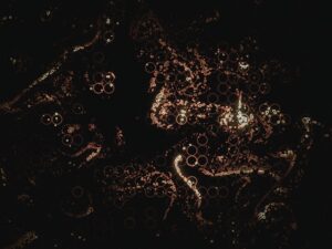 The Role of Antibodies in Autoimmune Diseases and Immune Dysregulation