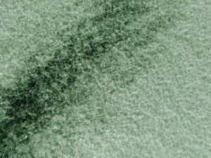 The Science of Antibody Isotypes and Their Differential Roles in Immune Defense Mechanisms